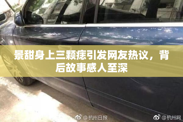 景甜身上三颗痣引发网友热议，背后故事感人至深