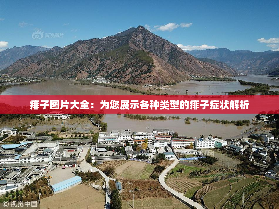 痱子图片大全：为您展示各种类型的痱子症状解析