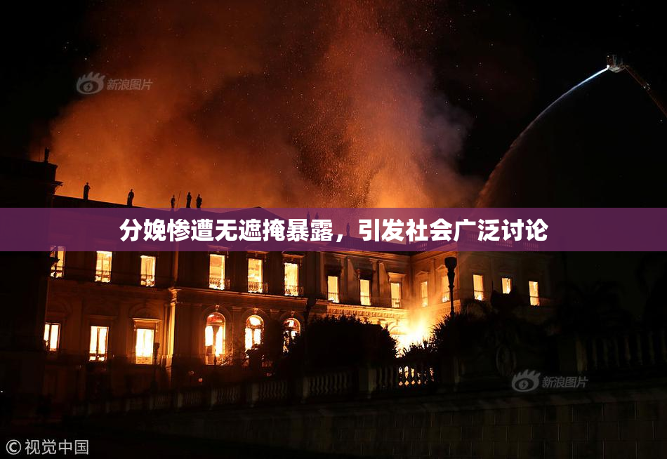 分娩惨遭无遮掩暴露，引发社会广泛讨论