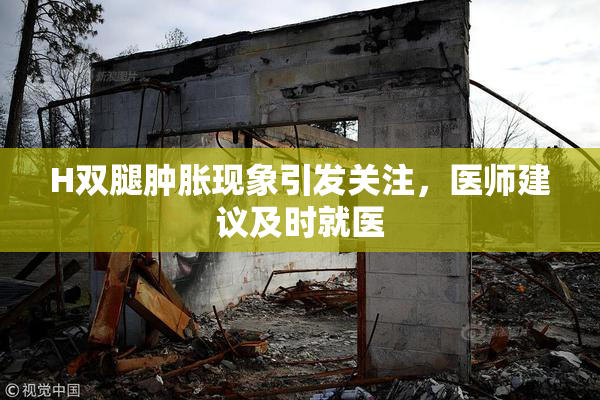 H双腿肿胀现象引发关注，医师建议及时就医
