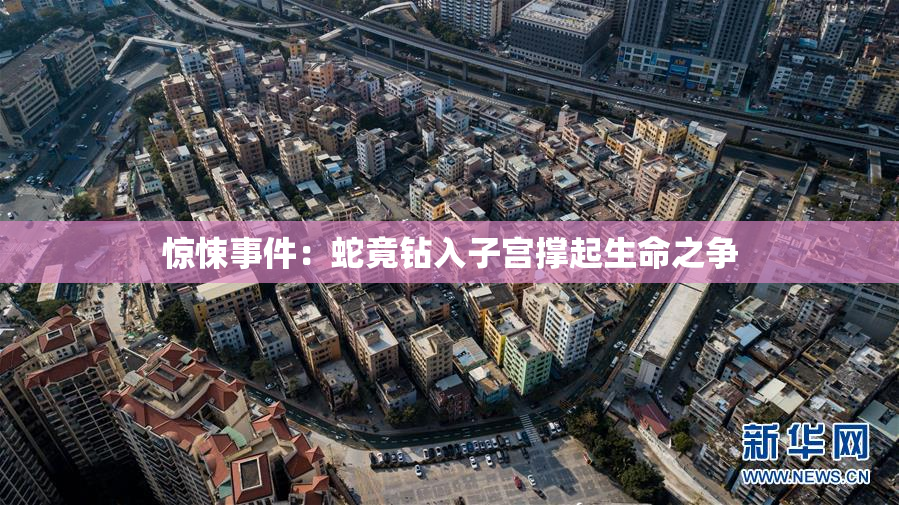 惊悚事件：蛇竟钻入子宫撑起生命之争