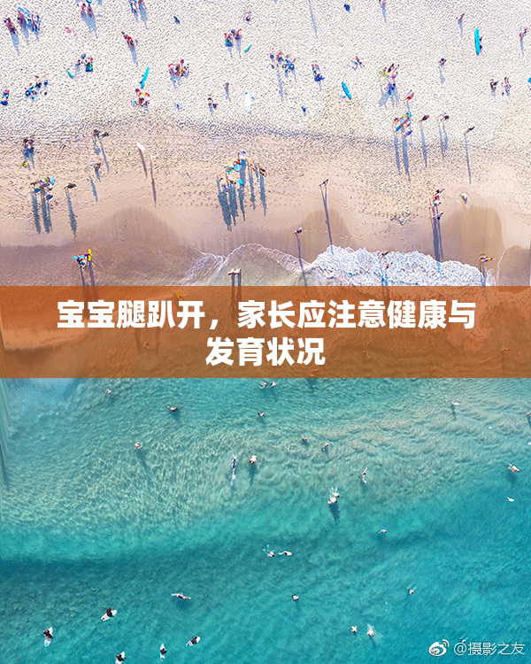 宝宝腿趴开，家长应注意健康与发育状况