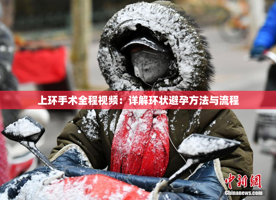 上环手术全程视频：详解环状避孕方法与流程
