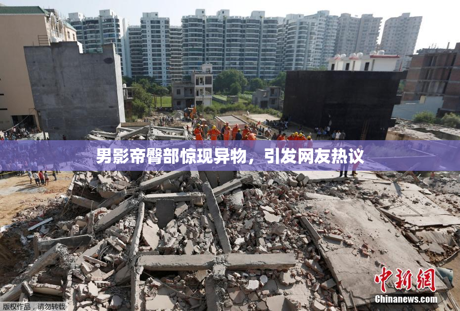 男影帝臀部惊现异物，引发网友热议