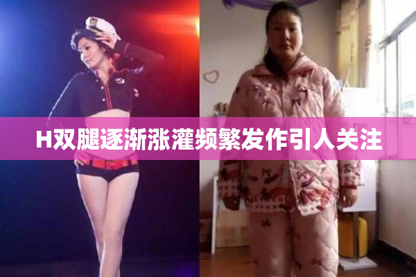 H双腿逐渐涨灌频繁发作引人关注
