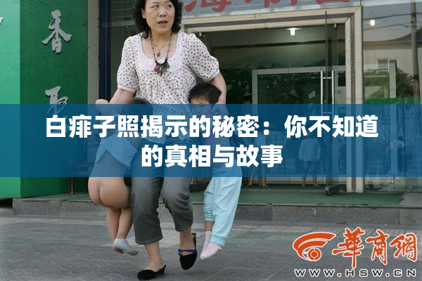 白痱子照揭示的秘密：你不知道的真相与故事