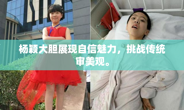 杨颖大胆展现自信魅力，挑战传统审美观。