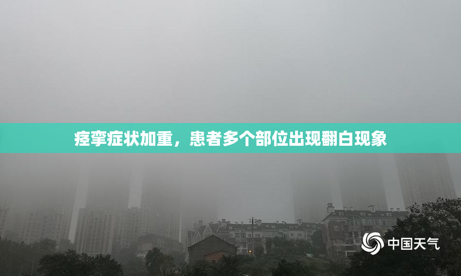 痉挛症状加重，患者多个部位出现翻白现象